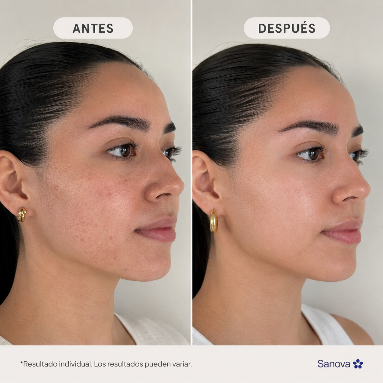 Sanova® Skin Balance